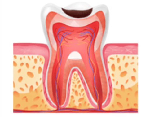 Can Cavities Really Heal on Their Own?
