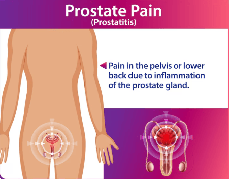 Natural Ways to Reduce Prostate Inflammation