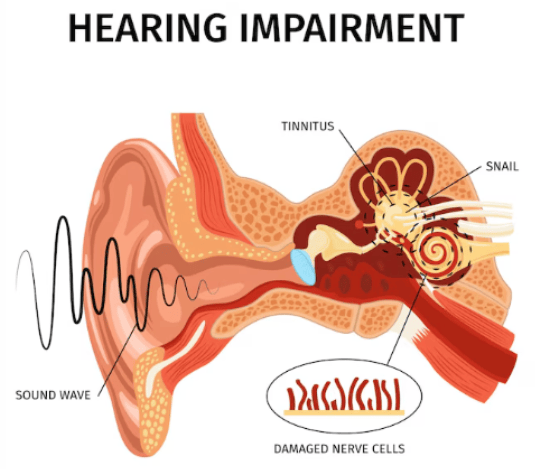 Tinnitus Explained: Causes, Natural Relief, and Prevention Tips