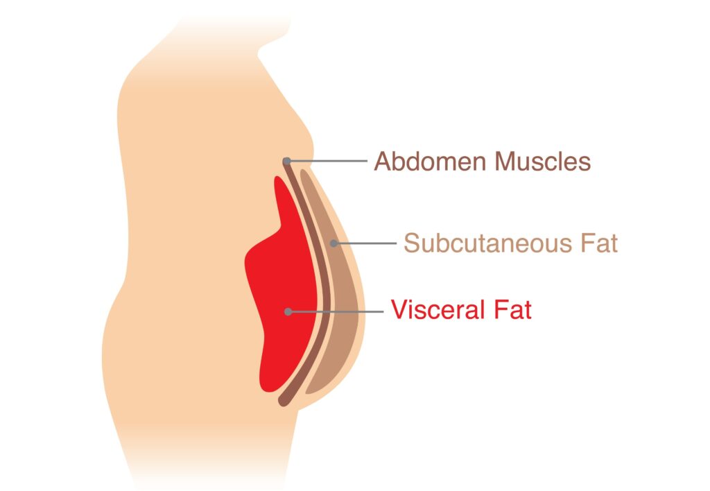Subcutaneous vs. Visceral Fat