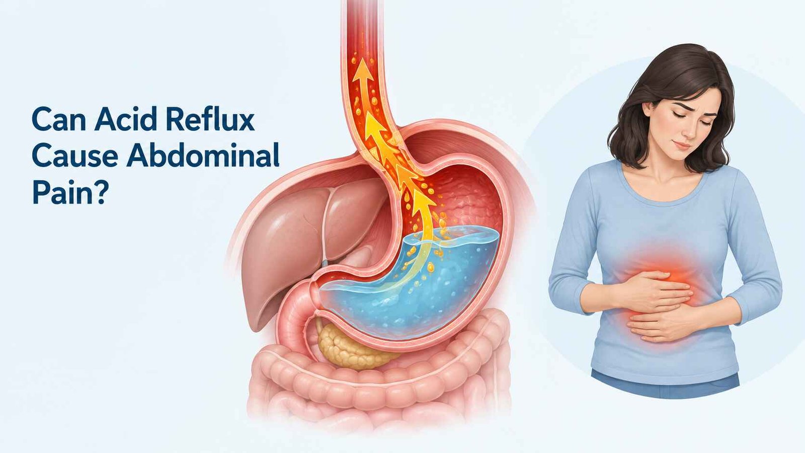 Medical illustration showing acid reflux moving from the stomach into the esophagus and highlighting possible upper abdominal discomfort.