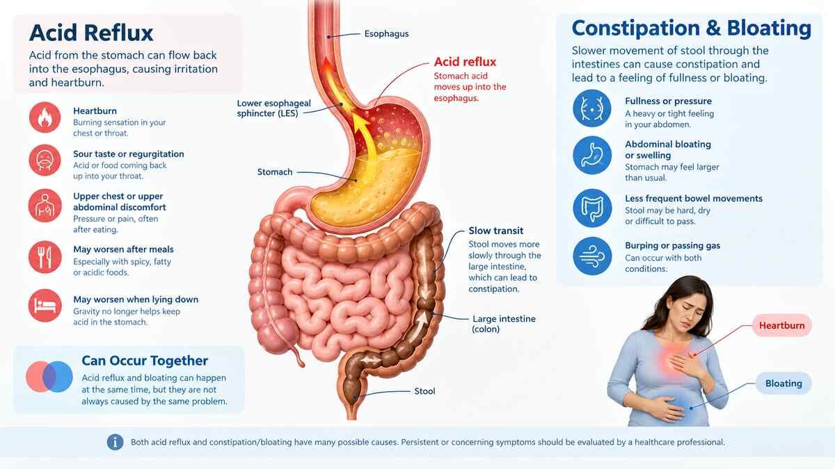Medical illustration comparing acid reflux and constipation-related bloating, showing the esophagus, stomach, intestines, reflux, and slowed stool movement.
