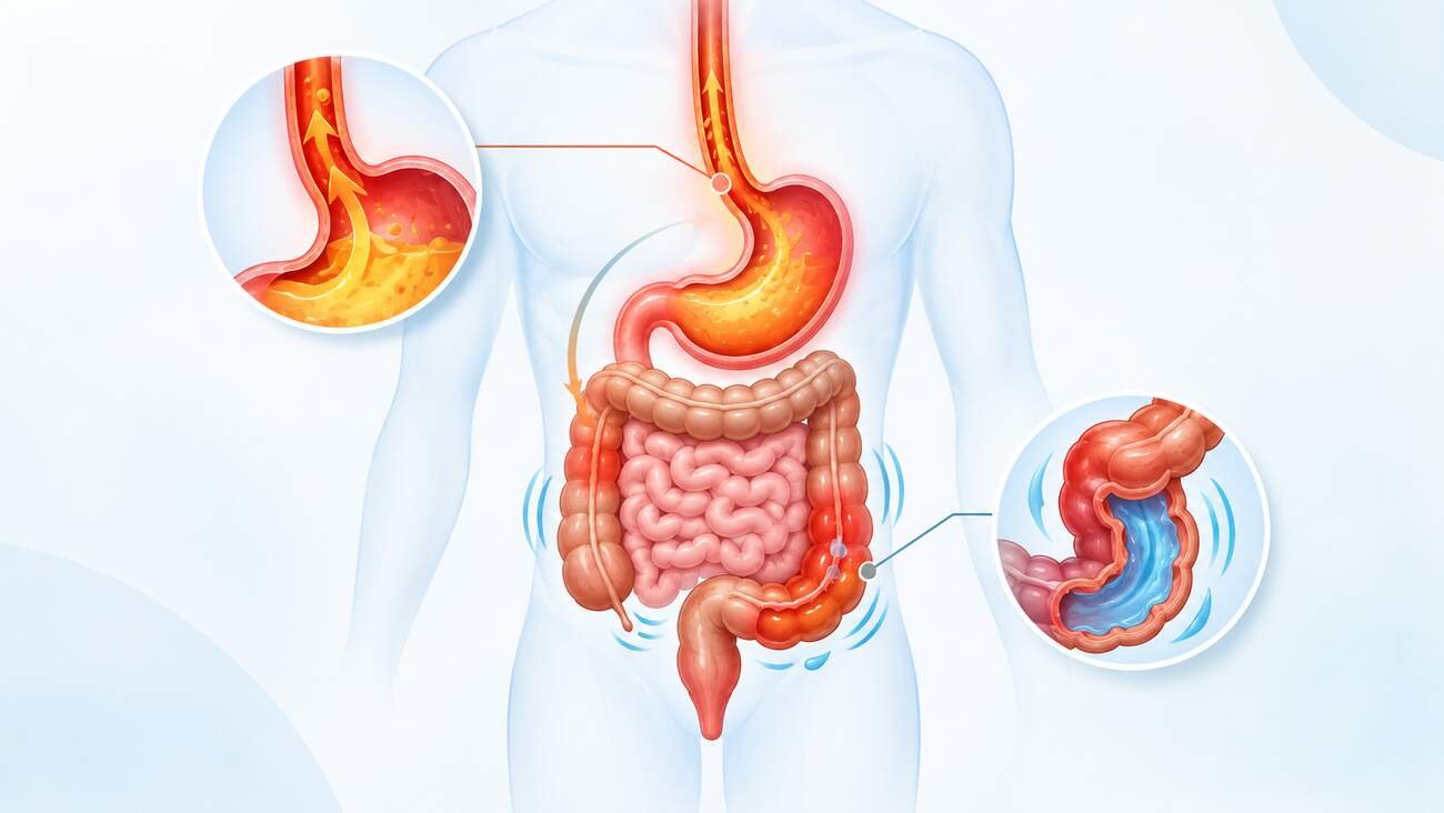 Medical illustration of acid reflux and diarrhea in the digestive system