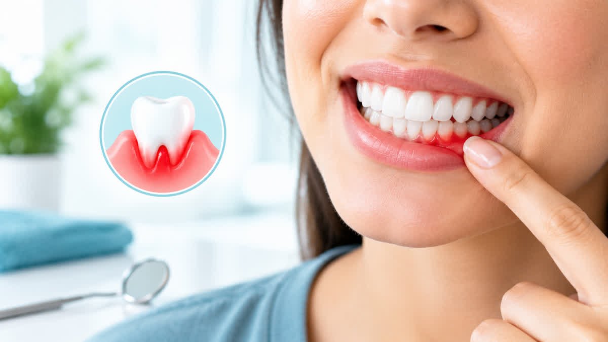 Close-up of gums along the teeth illustrating a common sign of gum inflammation.