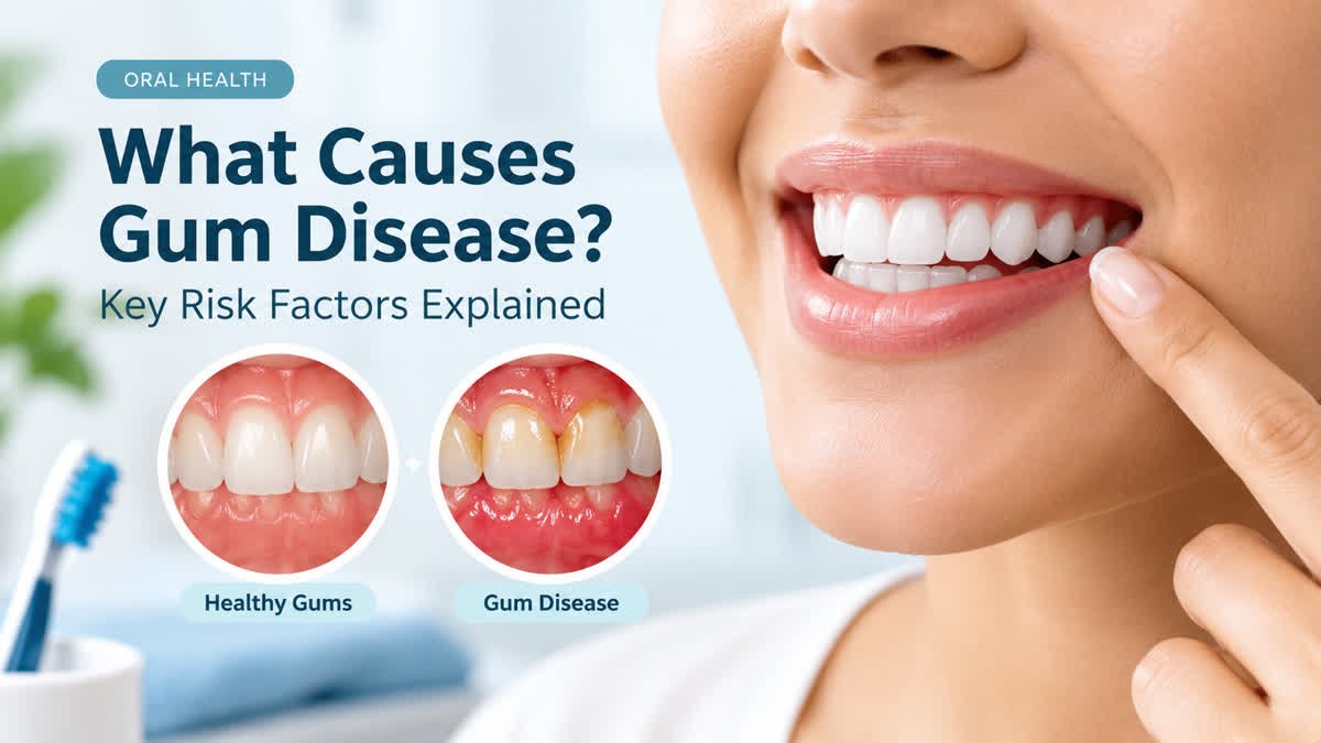 Educational comparison of healthy gums and gums affected by gum disease.